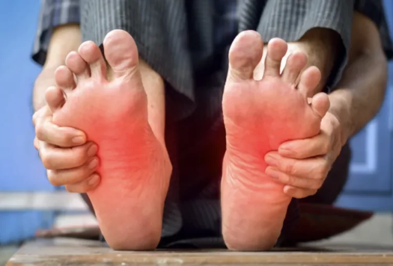 Arch Pain Treatment: Causes, Relief Options & When to See One of Our Specialists